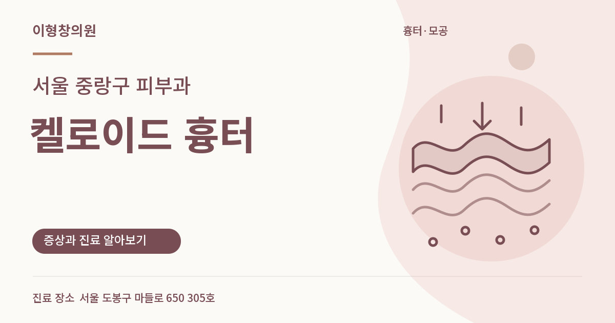 서울 중랑구 피부과 · 켈로이드 흉터 안내 썸네일